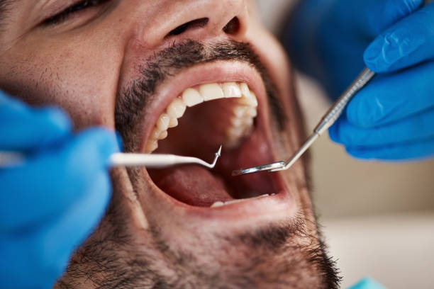 Best Emergency Dental Extractions in South Bloomfield, OH